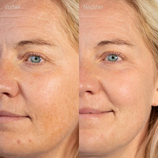 BLUE DROP MULTI-PEPTIDE SERUM